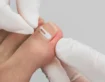 Tırnak Batması İçin Hangi Bölüme Gidilir?